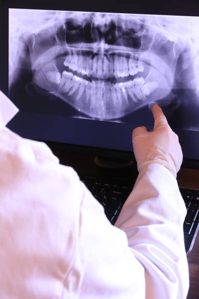 Best Emergency Dental Services for Seniors in Sebastopol, CA