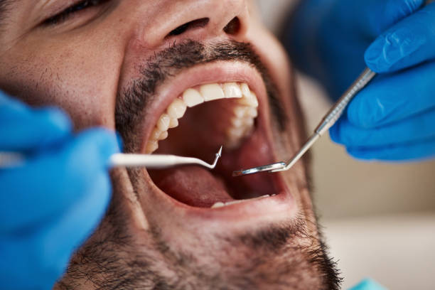 Best Broken or Cracked Tooth Emergency Dentist in Sebastopol, CA
